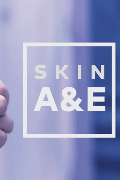 People Like Pus (Skin A and E) - Season 1
